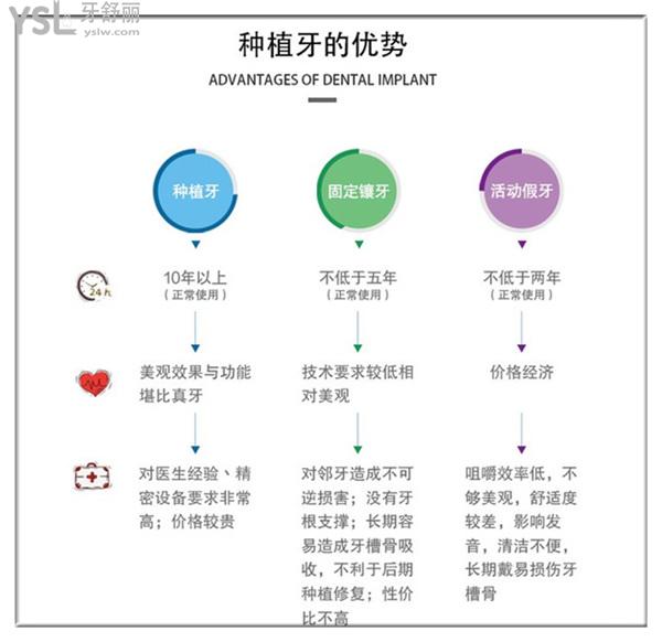 北京金圣口腔種植牙優(yōu)勢(shì)