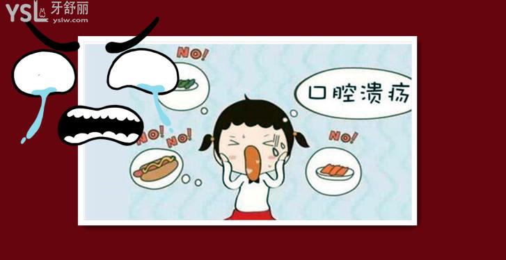 口腔潰瘍
