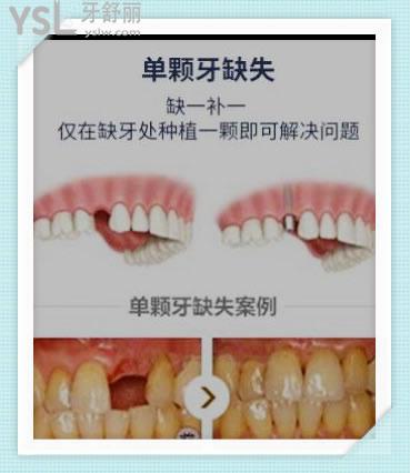 深圳格倫菲爾口腔