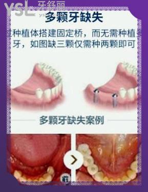 深圳格倫菲爾口腔