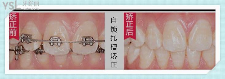 深圳格倫菲爾口腔