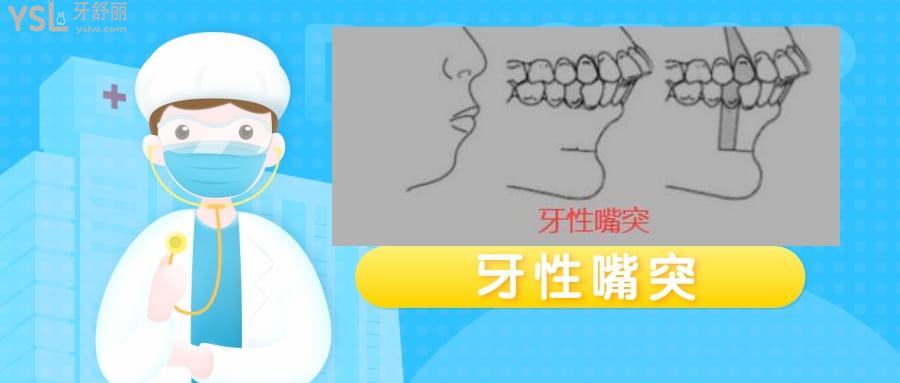 嘴突出側(cè)面很難看怎么矯正多少錢(qián)