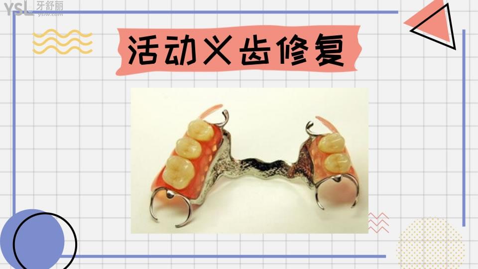 牙齒修復的幾種方法和價格如何呢 .jpg