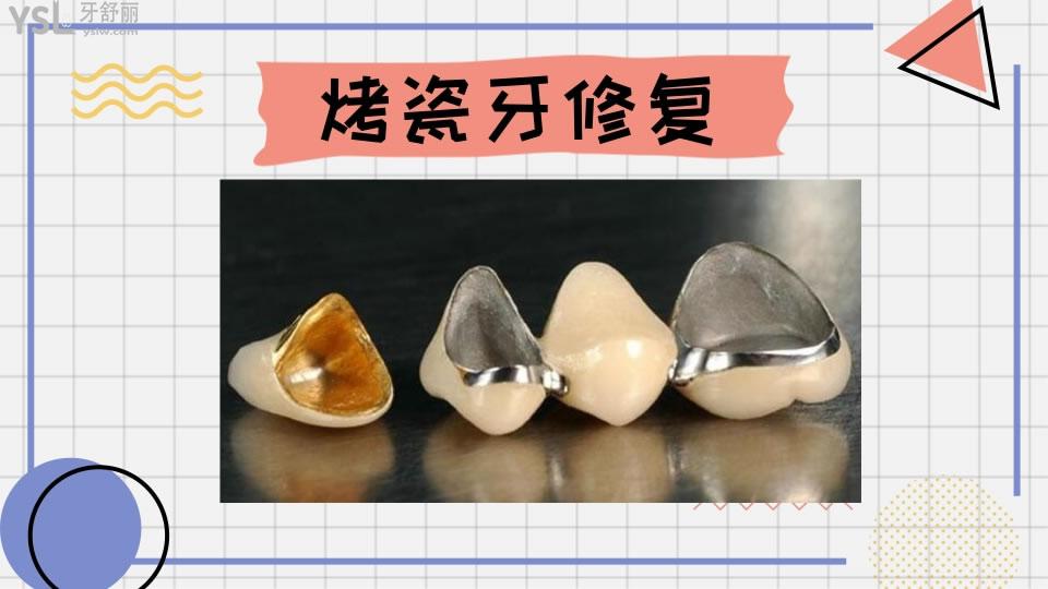 牙齒修復的幾種方法和價格如何呢 .jpg