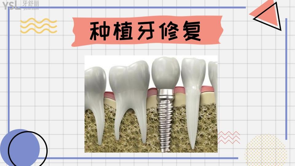 牙齒修復的幾種方法和價格如何呢 .jpg