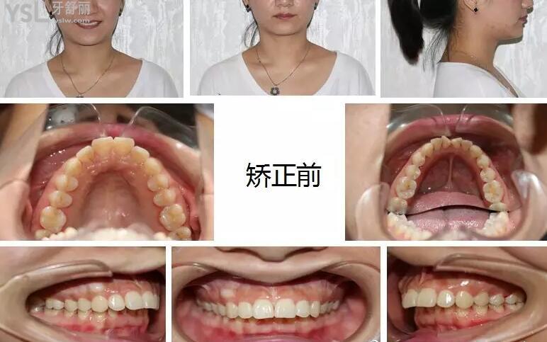戴政矯正<span style=