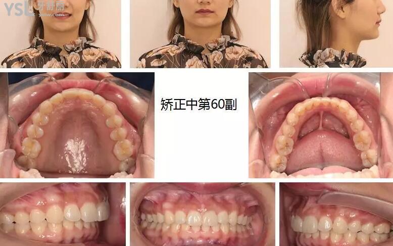 戴政矯正<span style=