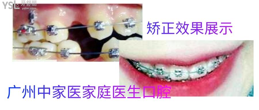 中家醫(yī)家庭口腔醫(yī)院怎么樣