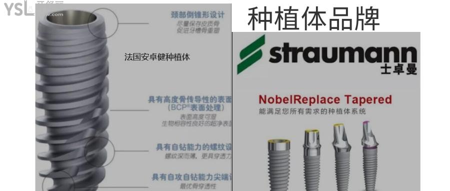 種植牙什么時(shí)候降價(jià)
