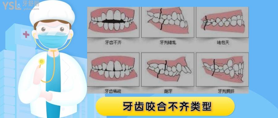 牙齒對(duì)不齊門牙跟下牙碰不到