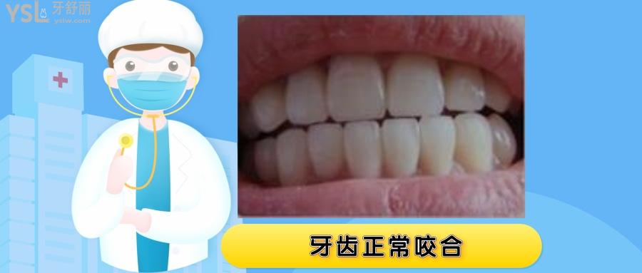 牙齒對(duì)不齊門牙跟下牙碰不到