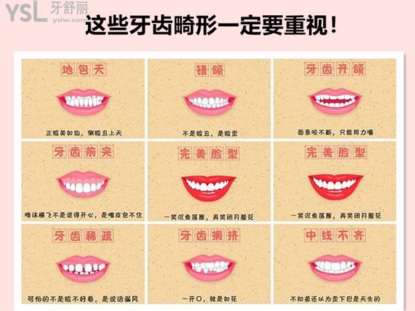 牙齒畸形的幾種情況