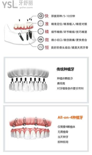 傳統(tǒng)種植牙和ALL-ON-4種植牙對比