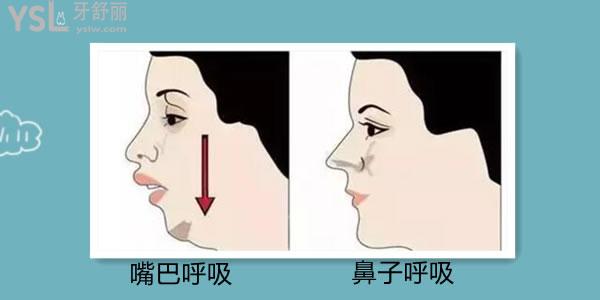 整牙可以改變下巴后縮嗎，下巴后縮影響大嗎