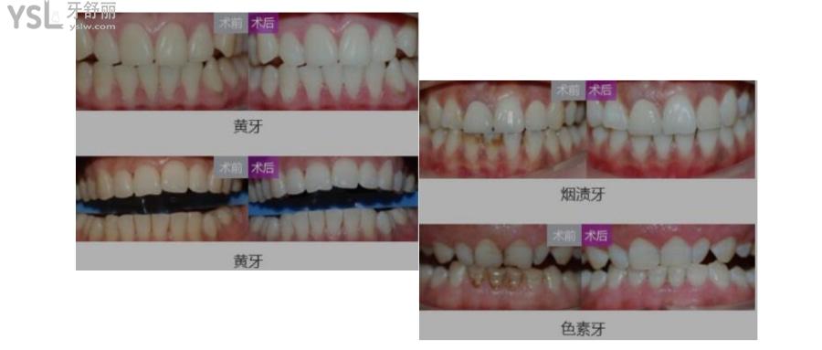 深圳美萊口腔