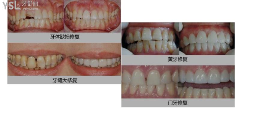 深圳美萊口腔