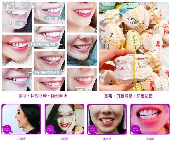 天津美萊口腔醫(yī)院怎么樣 是正規(guī)的嗎 技術(shù)可靠嗎 收費(fèi)貴嗎