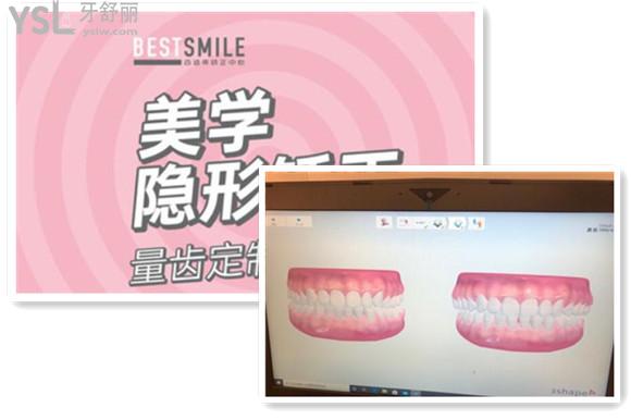 美學(xué)定制