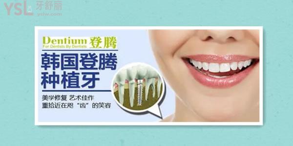 韓國種植體有哪幾種 價格差別大嗎