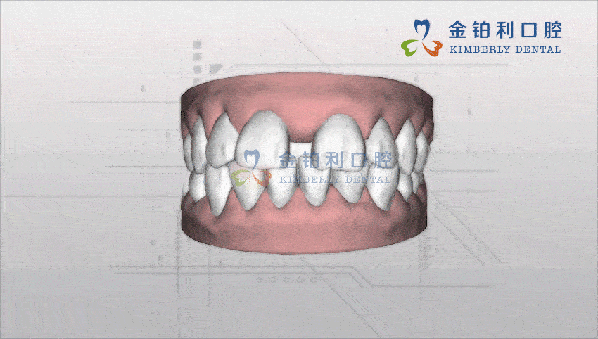 兒童牙齒矯正南京哪家醫(yī)院比較好