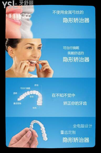 comfos隱形牙套 時代天使標(biāo)準(zhǔn)版和雙模版更適用哪些人群 這幾款性價(jià)比哪個更高.jpg