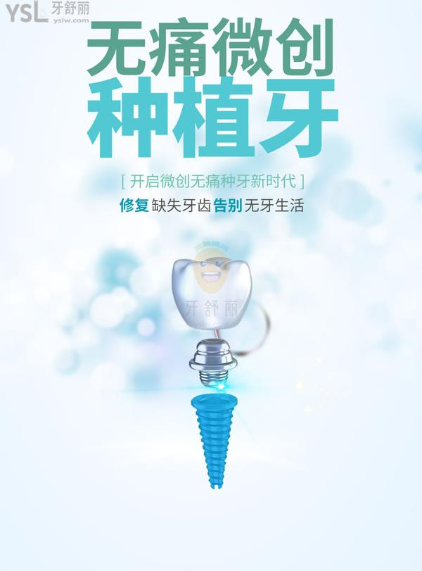 韓國種植牙品牌排行名稱爆料，一文看透韓國種牙植體哪個(gè)品牌好