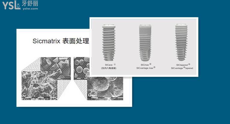 瑞士sic種植體和iti哪個(gè)好