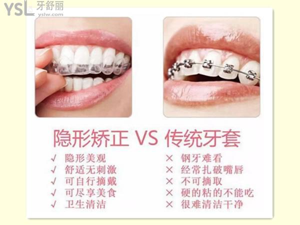 隱形矯正對比傳統(tǒng)牙套的優(yōu)勢