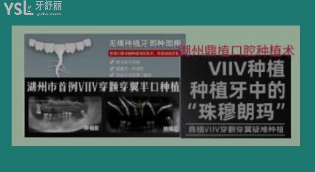 湖州看牙科哪個醫(yī)院好