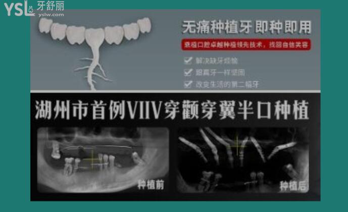 湖州看牙科哪個醫(yī)院好