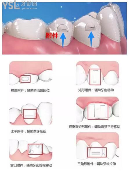 附件的類型