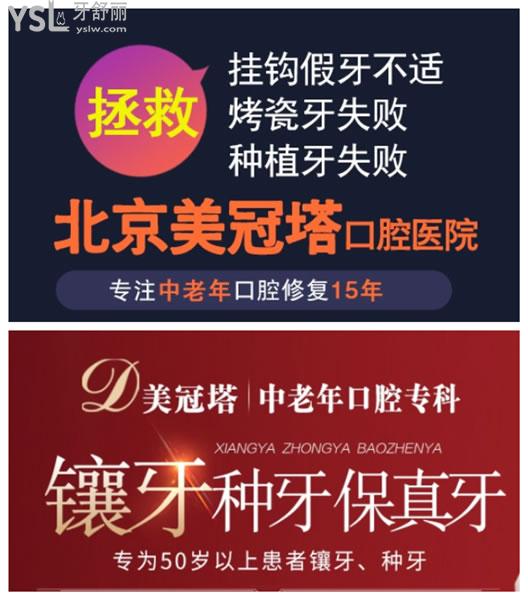 美冠塔口腔技術優(yōu)勢