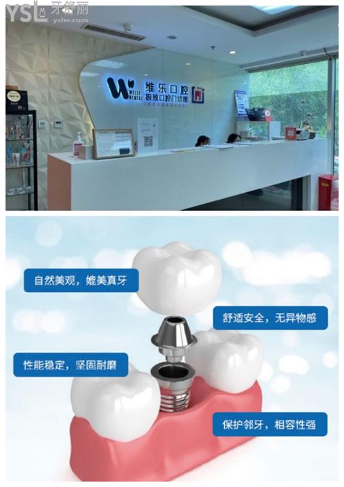 北京維樂口腔種植牙優(yōu)勢