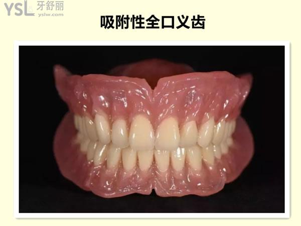 吸附性義齒