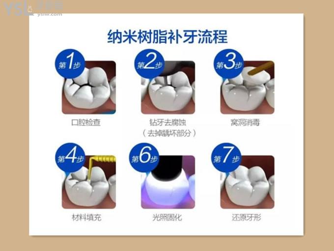 補(bǔ)牙過程