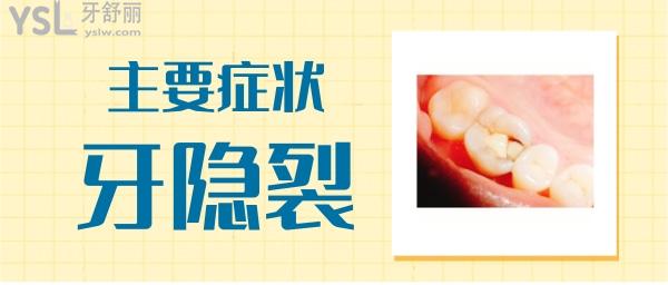 牙隱裂癥狀