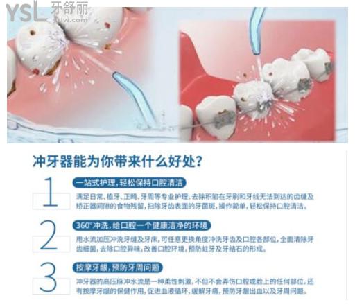 沖牙器的好處和壞處知乎