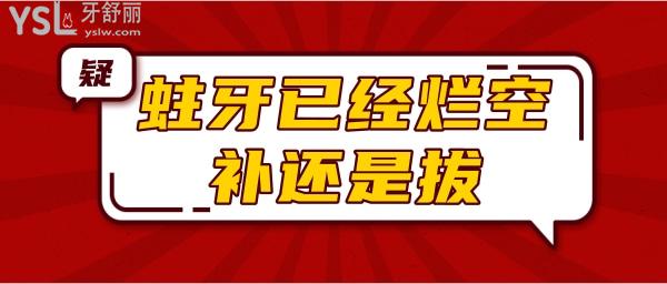 蛀牙已經(jīng)爛空補(bǔ)還是拔.jpg