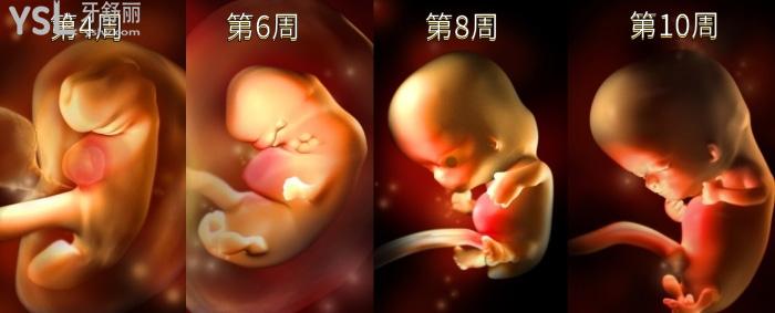 腭裂唇是什么原因，如何預防？.jpg