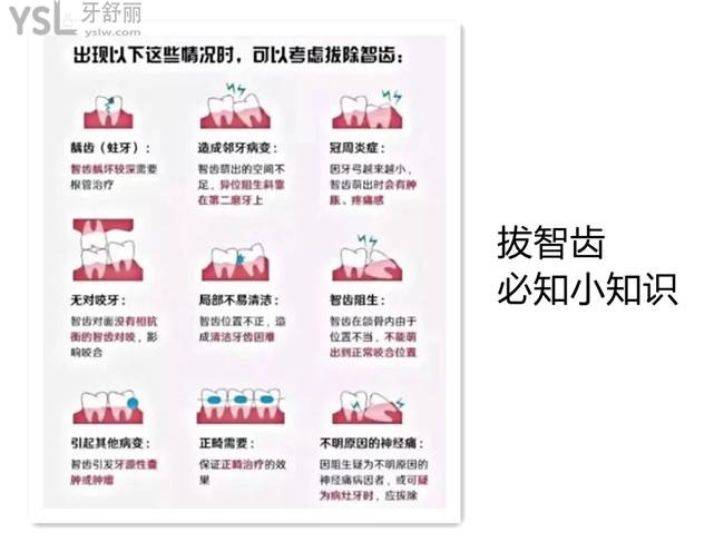 什么情況需要拔智齒