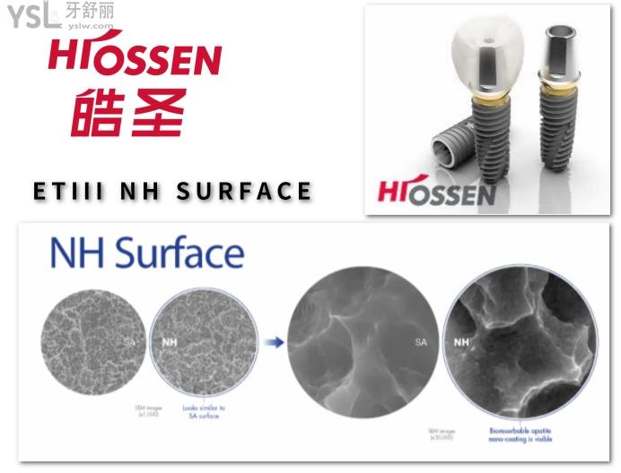 美國(guó)HIOSSEN皓圣種植體