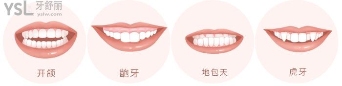 成人盡量不要矯正牙齒？究竟是有風(fēng)險(xiǎn)還是怕你<span style=