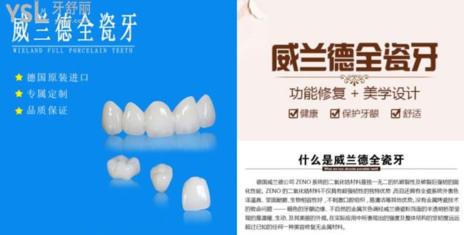 德國(guó)威蘭德全瓷牙