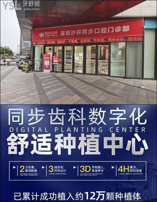深圳沙井同步齒科種植牙技術(shù)