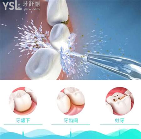 家用沖牙器真的是百利無一害嗎 好處和壞處有哪些 .jpg