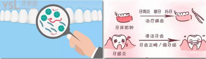 長(zhǎng)期口氣臭是什么原因？怎么辦治療好？