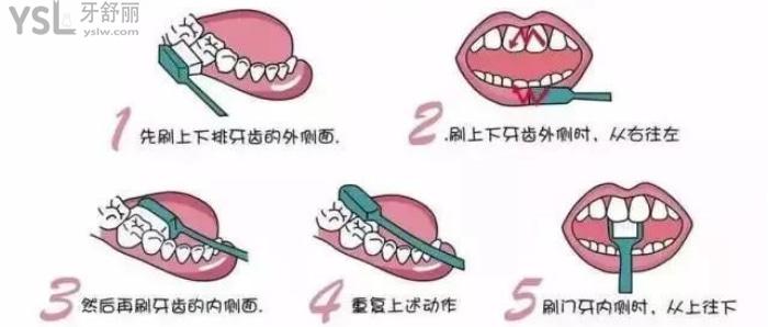 長(zhǎng)期口氣臭是什么原因？怎么辦治療好？