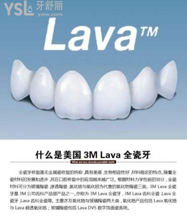 美國3M拉瓦全瓷貼面