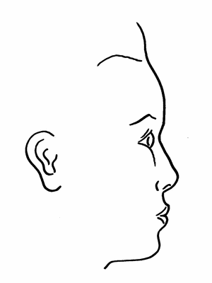 做凸嘴手術(shù)過(guò)程痛苦嗎