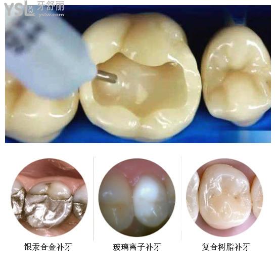 沈陽渾南區(qū)補(bǔ)牙去哪個(gè)牙科便宜